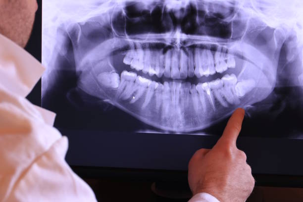 Best Emergency Treatment for Dental Infections or Abscesses in Germantown, OH