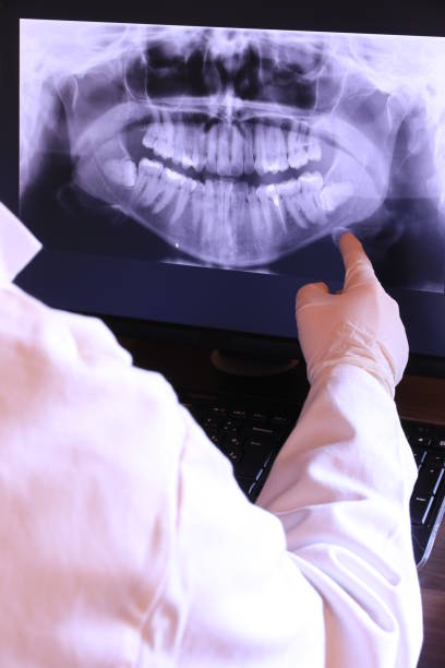 Best Emergency Dental Care for Broken or Chipped Teeth in Germantown, OH